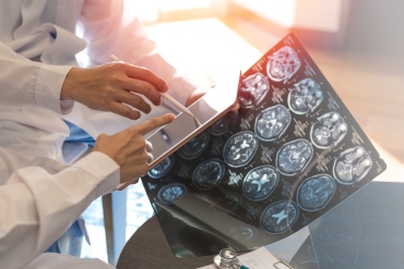 medical team looking a brain scan