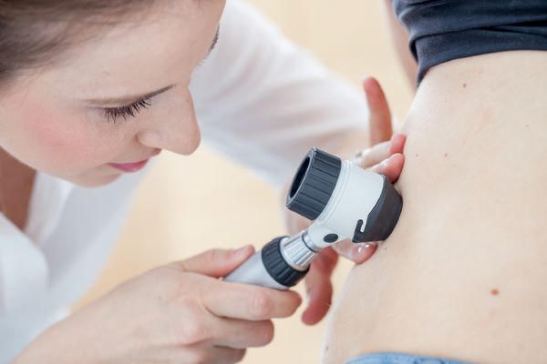 doctor checking skin for skin cancer