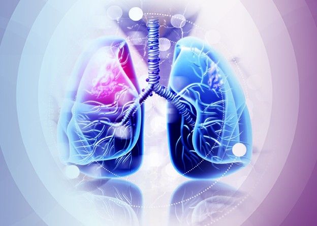 inside of lung showing tumor